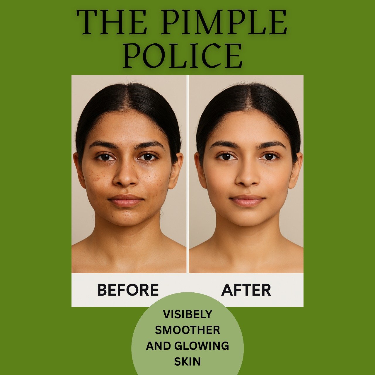 The Pimple Police - 100gm Neem Face Pack for Men & Women - Image 2